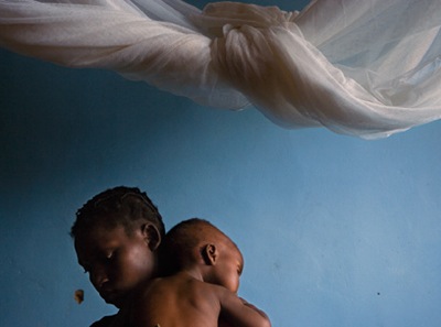 malaria patients at Kalene Mission Hospital in Zambia